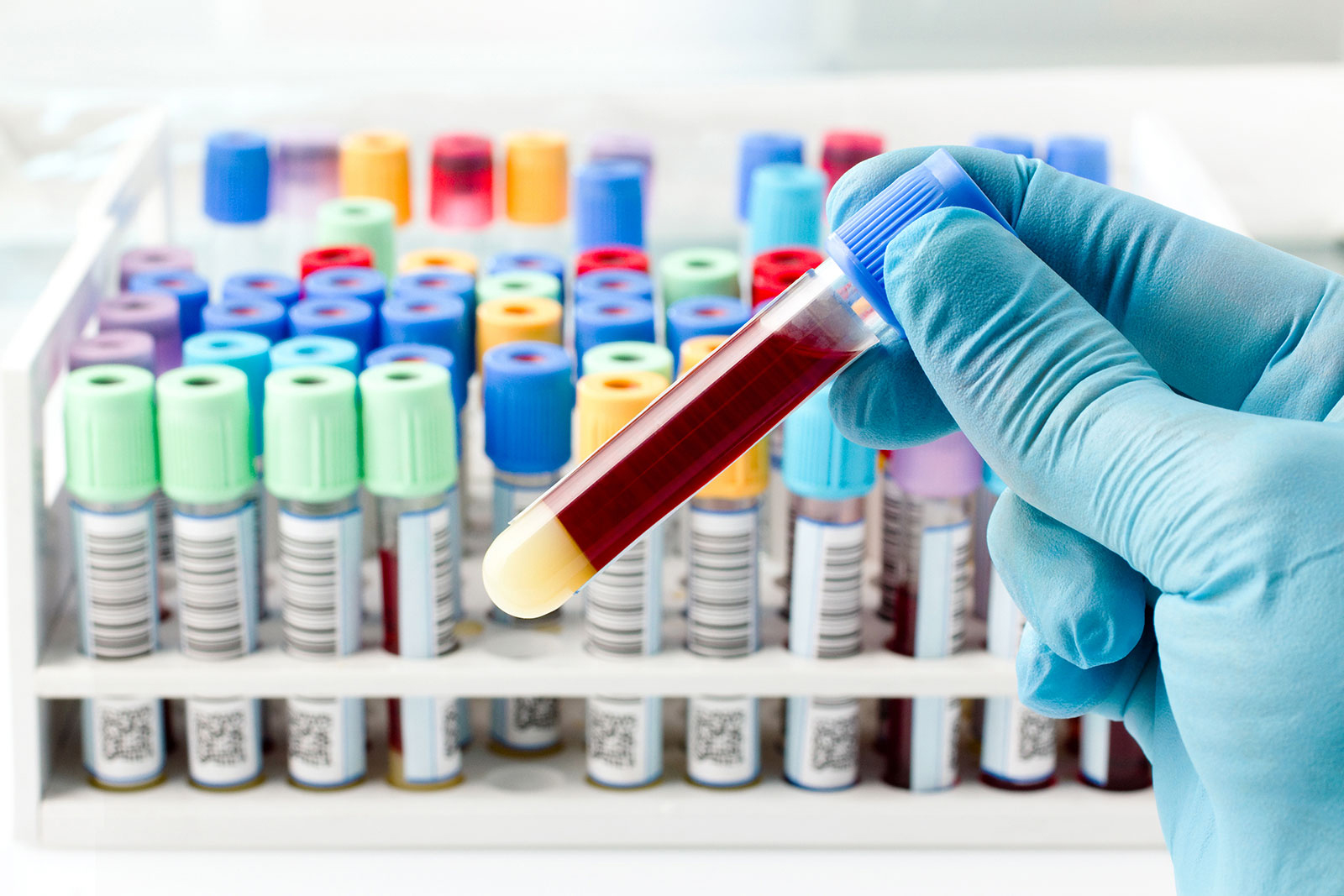 Blood in vial