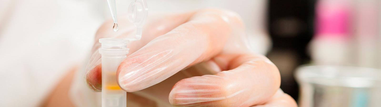 Hand holding a pipet